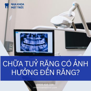 Chữa tủy răng có ảnh hưởng đến răng không? – Nha khoa Mặt Trời Quận 2