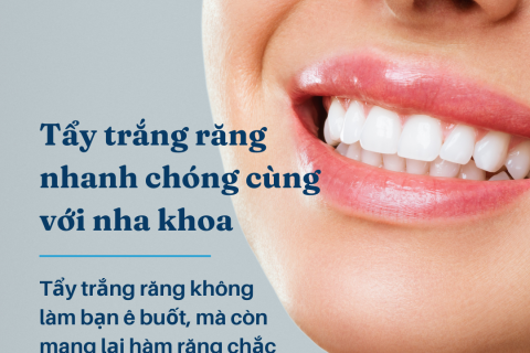 TẨY TRẮNG RĂNG NHANH CÓ LÀM RĂNG Ê BUỐT KHÔNG?